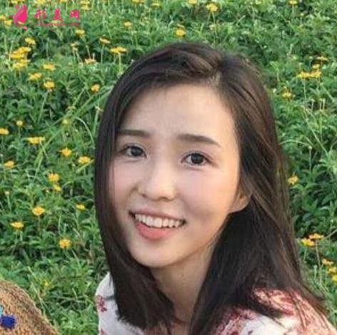 西安唐都醫(yī)院雙眼皮誰做得好？專家案例真實效果反饋！價格表不要錯過！