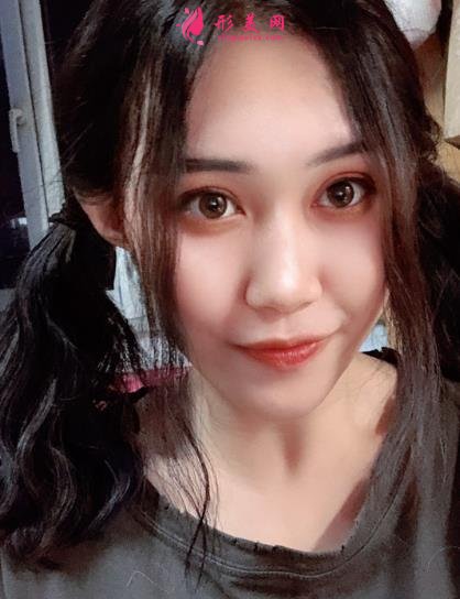 上海伊萊美醫(yī)療美容醫(yī)院做雙眼皮怎么樣？案例真實反饋_整形價格一覽