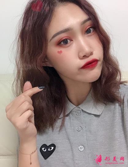 上海伊萊美醫(yī)療美容醫(yī)院做雙眼皮怎么樣？案例真實反饋_整形價格一覽