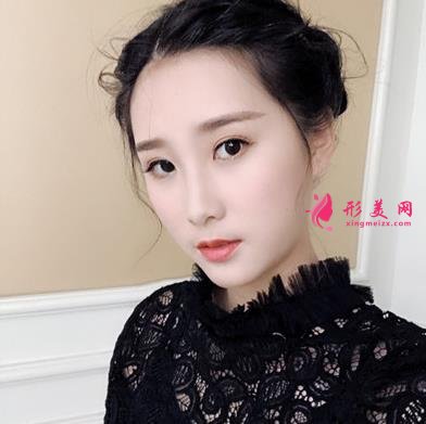 無錫曼陀羅醫(yī)院上臉下垂矯正案例_整形美容價格表請查收！