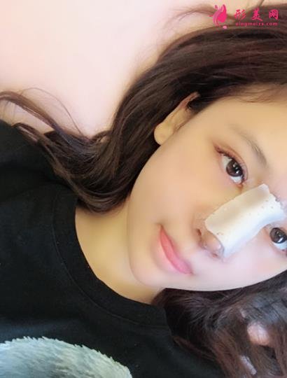 佛山華美整形醫(yī)院隆鼻做的咋樣？案例效果價格（價目）表供參考