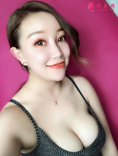 北京301醫(yī)院陳猶白取奧美定怎么樣？案例圖術(shù)后恢復(fù)記錄新公開