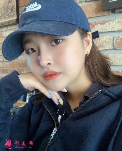 上海伊萊美李湘原做下頜角怎么樣?真人案例術(shù)后三個月效果展示