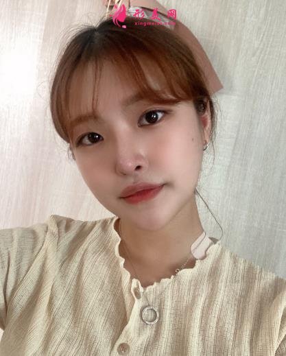 上海伊萊美李湘原做下頜角怎么樣?真人案例術(shù)后三個月效果展示