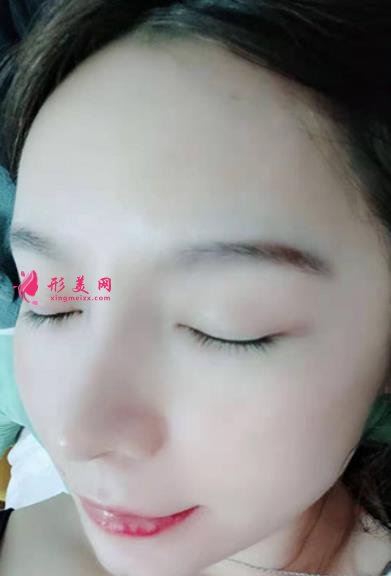 2021上海九院戴傳昌做鼻子價格表!在對比真人隆鼻案例實拍