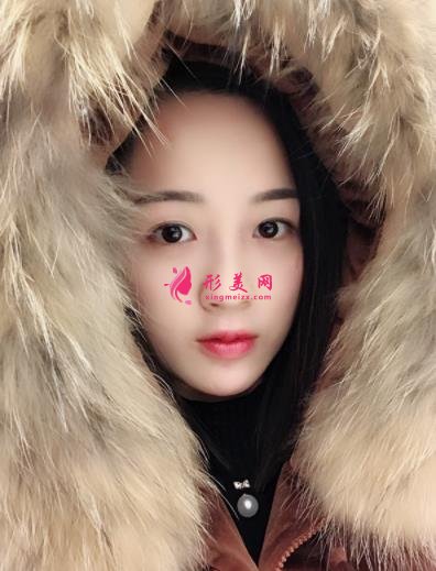 長(zhǎng)沙湘雅三院整形科怎么樣？全新隆鼻案例及價(jià)格價(jià)目表對(duì)比盤(pán)點(diǎn)