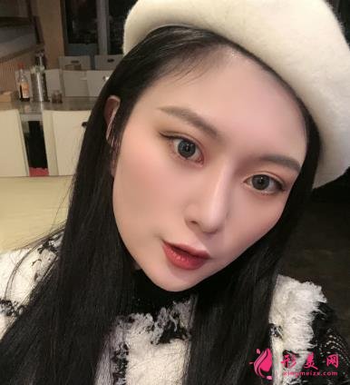 深圳陽光整形醫(yī)院雙眼皮怎么樣？效果好嗎？手術(shù)真實(shí)價(jià)格費(fèi)用參考