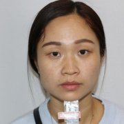 深圳北大醫(yī)院整形科做雙眼皮怎么樣？案例及價格表（多少錢）在線