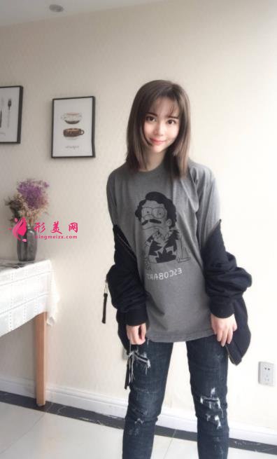 上海長(zhǎng)征醫(yī)院整形科面部吸脂怎么樣？術(shù)后瘦臉效果跟美顏相機(jī)說(shuō)再見(jiàn)！