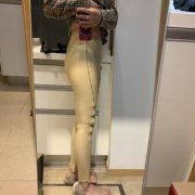 新疆醫(yī)科大學(xué)第一附屬醫(yī)院整形科怎樣？通過真實(shí)吸脂案例對比讓你