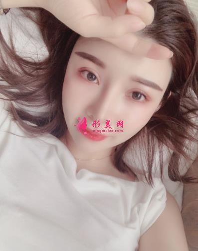南京康美馮思陽隆鼻怎么樣？看完下面真實(shí)案例及價格收費(fèi)表再來評價