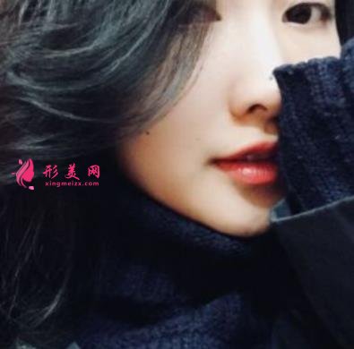 重慶星榮整形外科醫(yī)院整形外科自體脂肪全臉填充案例+價(jià)格表提前一覽