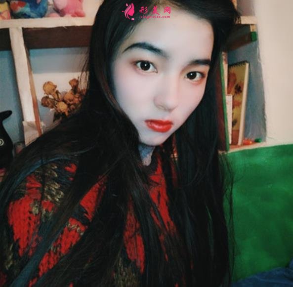 武漢同濟醫(yī)院整形科（公立）價格收費標準更新！隆鼻案例全面公開~