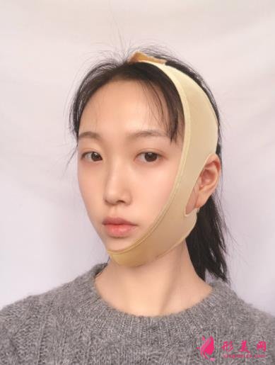 云南省中醫(yī)院美容科怎么樣?看專家顴骨案例及部分項目價格表收費明細