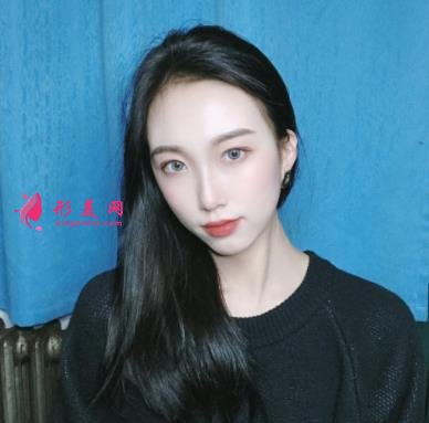 云南省中醫(yī)院美容科怎么樣?看專家顴骨案例及部分項目價格表收費明細