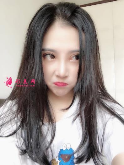 南陽市中心醫(yī)院整形怎么樣？隆鼻案例效果反饋圖及新版價格表正式公開