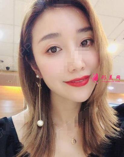 衡水整形醫(yī)院哪家好？排名前三口碑推薦_含除皺（頸紋）案例效果圖