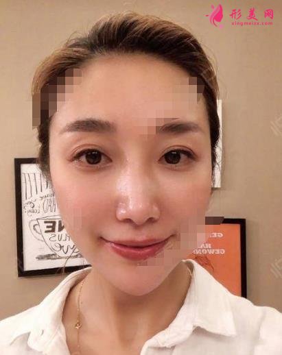 衡水整形醫(yī)院哪家好？排名前三口碑推薦_含除皺（頸紋）案例效果圖