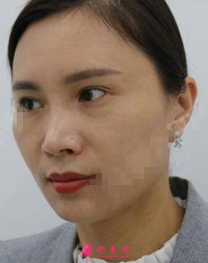 松原口碑好的整形醫(yī)院有哪些？排名前三權(quán)威發(fā)布_陽光、海峽實力領(lǐng)銜