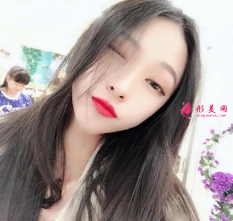 江西豐城整形美容院哪個(gè)好？排名前三口碑機(jī)構(gòu)推薦_丁宇實(shí)力領(lǐng)銜