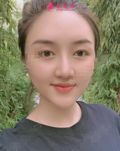 衡陽(yáng)微整形醫(yī)院哪家好？排名前三口碑機(jī)構(gòu)盤點(diǎn)_愛思特實(shí)力領(lǐng)銜榜首