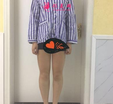 蘭州仁和醫(yī)院抽脂價目表公開公示_手術(shù)恢復過程真實圖片分享