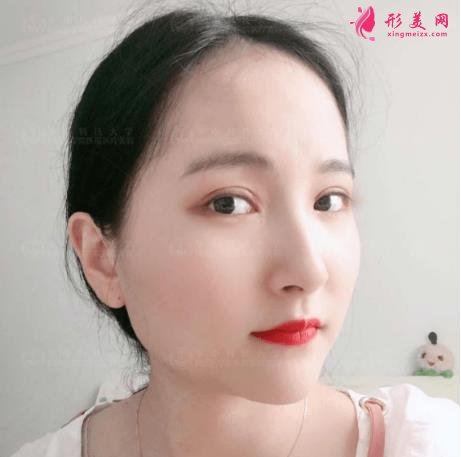 濟(jì)南中心醫(yī)院整形科怎么樣？附雙眼皮價格披露及案例效果一覽