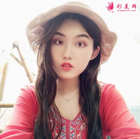 南昌韓美美容醫(yī)院正規(guī)嗎？隆鼻案例照片了解，效果不錯哦！