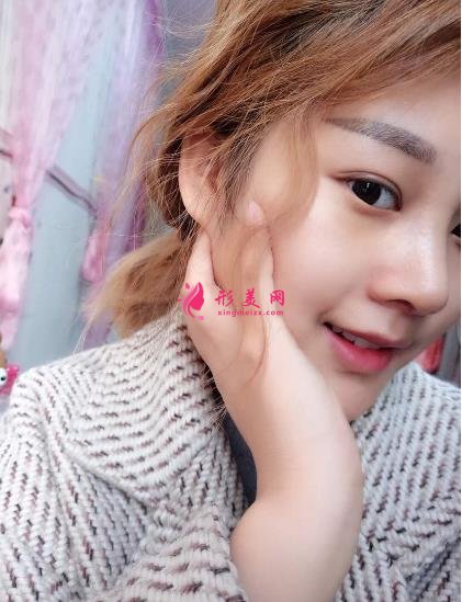北京藝星和北京壹加壹做鼻子哪家好？了解一下案例和隆鼻醫(yī)生技術(shù)特點(diǎn)