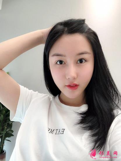 成都排名第一的整容醫(yī)院是誰？對比華西口腔李繼華磨骨案例怎么樣？