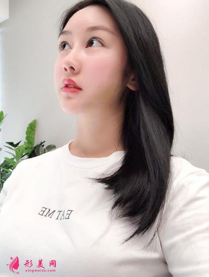 成都排名第一的整容醫(yī)院是誰？對比華西口腔李繼華磨骨案例怎么樣？