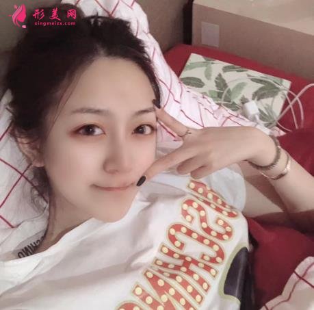 西安熱瑪吉五代哪里可以做？西京醫(yī)院整形案例和費(fèi)用多少