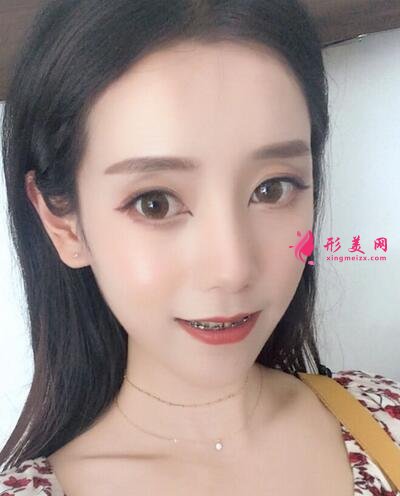 北京牙管家口腔醫(yī)院靠譜嗎?價格表|簡介|正畸案例效果反饋
