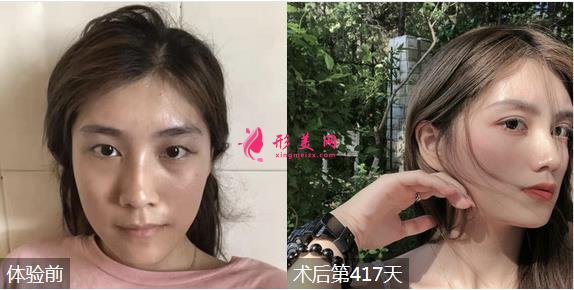 南京鼓樓醫(yī)院整形科醫(yī)生排名_案例對比圖_2020價格表全面公布！