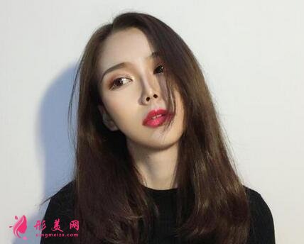 包頭第四醫(yī)院整形美容科怎么樣？價格表|雙眼皮案例一覽