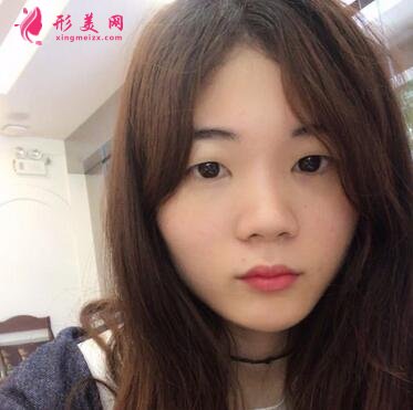 浙江省中醫(yī)院整形科去眼袋怎么樣？?jī)r(jià)格表|簡(jiǎn)介|案例效果多圖反饋