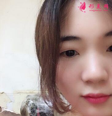 浙江省中醫(yī)院整形科去眼袋怎么樣？?jī)r(jià)格表|簡(jiǎn)介|案例效果多圖反饋