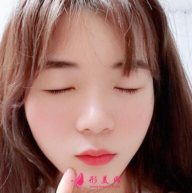 浙江省中醫(yī)院整形科去眼袋怎么樣？?jī)r(jià)格表|簡(jiǎn)介|案例效果多圖反饋