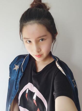 成都美未央鼻綜合手術恢復日記圖