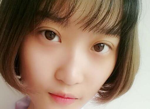 切開雙眼皮多少錢？割雙眼皮真實(shí)案例多對比圖分享