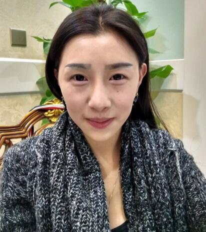 武漢愛美匯自體脂肪填充全臉經(jīng)驗(yàn)