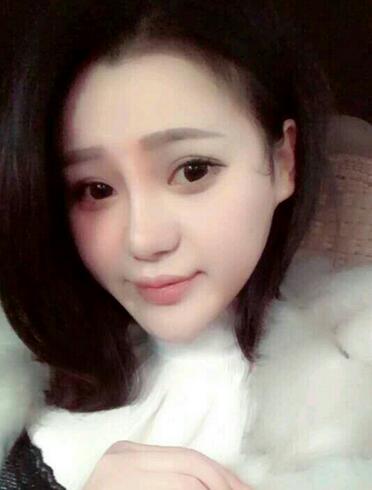 上海九院李圣利鼻綜合真實(shí)恢復(fù)期圖片
