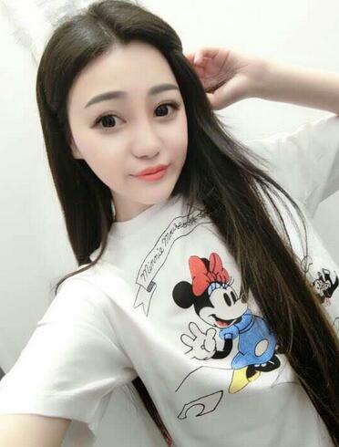 上海九院李圣利鼻綜合真實(shí)恢復(fù)期圖片