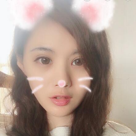 武漢樂美開眼角+雙眼皮3個(gè)月恢復(fù)圖片