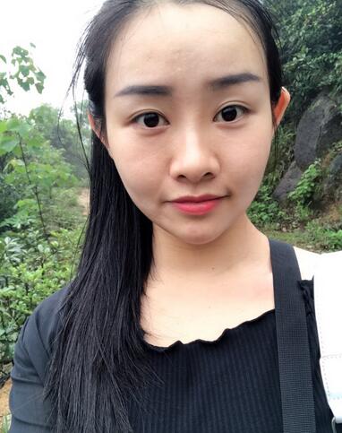 武漢樂(lè)美韓式微創(chuàng)雙眼皮+開(kāi)內(nèi)眼角