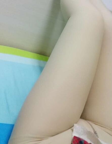 吸脂減肥瘦大腿前后對比圖，光纖溶脂瘦大腿最有效的方法真實案例