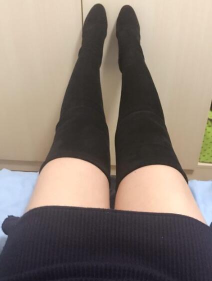 吸脂減肥瘦大腿前后對比圖，光纖溶脂瘦大腿最有效的方法真實案例