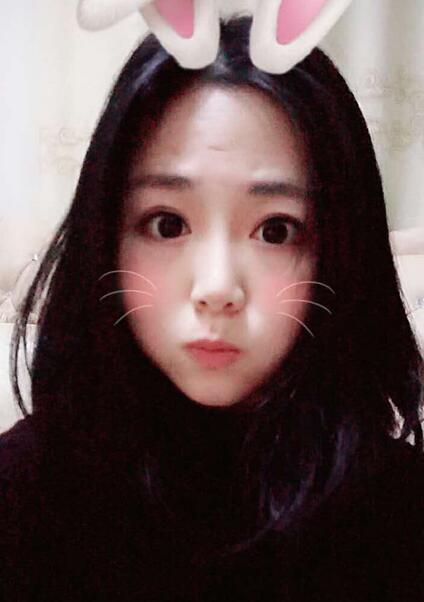 全切雙眼皮恢復(fù)過程 天津伊頌雙眼皮案例