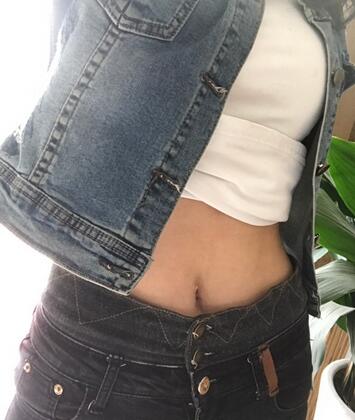 腹部吸脂兩個月親身經歷 深圳仁安雅吸脂案例