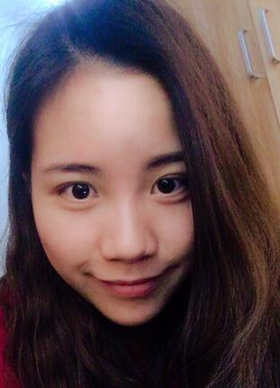北京藝星王英勇隆鼻案例 鼻綜合三個月